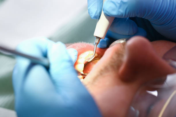 Best Emergency Dentist for Special Needs Patients in Asheville, NC