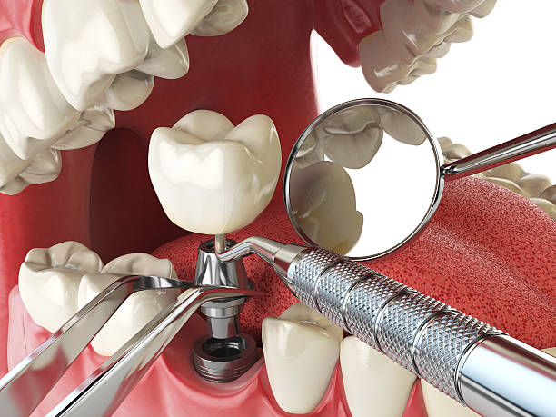 Best Emergency Dental Services for Seniors in Asheville, NC
